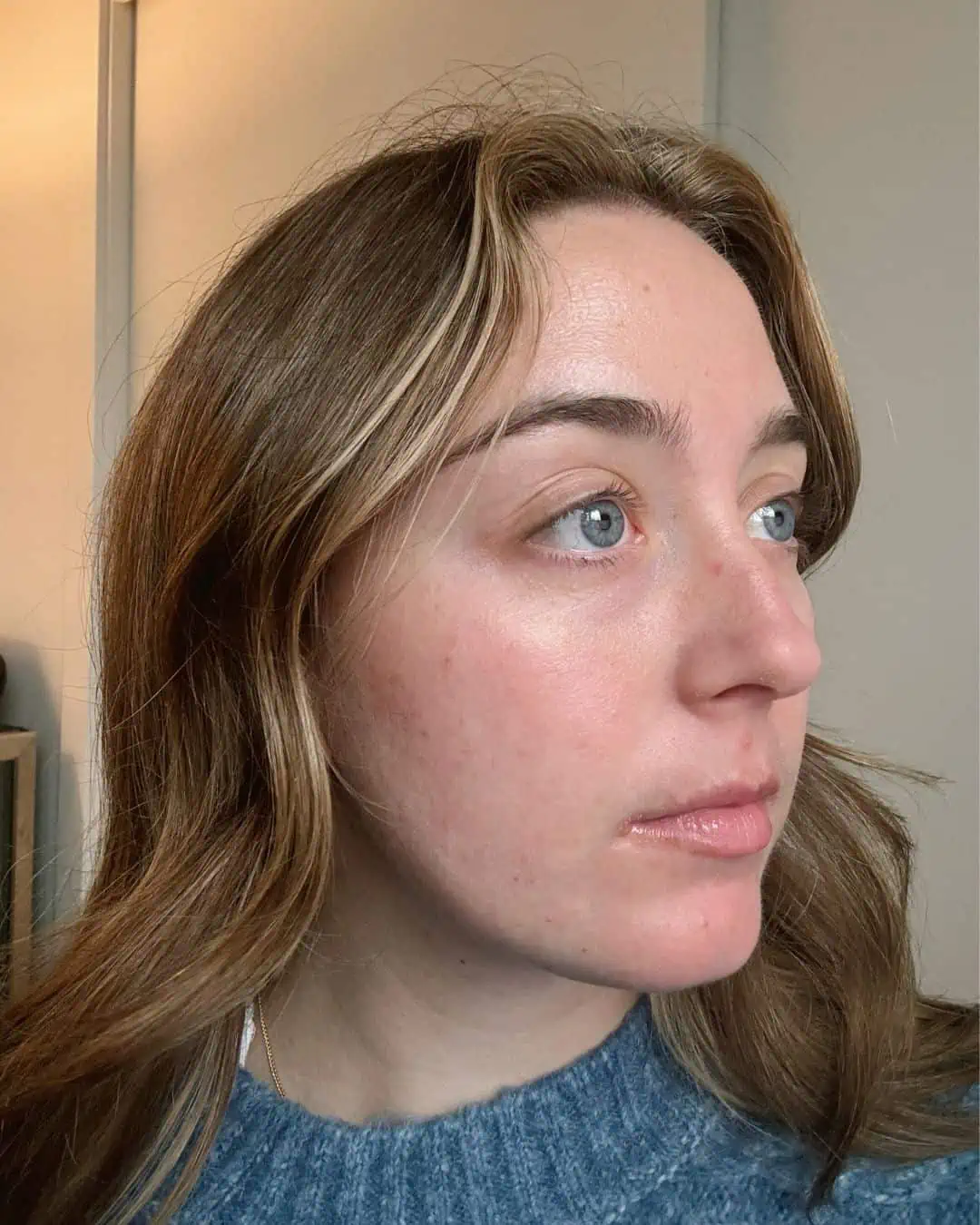 Accutane Skincare Routine & Product Recommendations